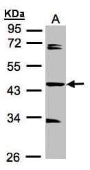 IHC-plus™ Polyclonal Rabbit anti-Human SDCCAG3 Antibody (aa218-435, IHC, WB)