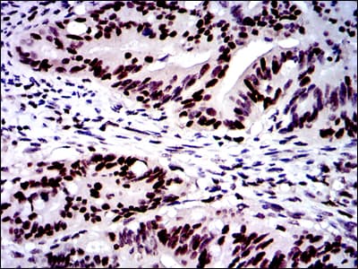MSH6 Antibody (clone 30)