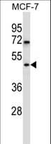 WDR88 Antibody (aa377-406)