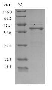 Lithobates catesbeiana Saxiphilin Protein (Recombinant 6His, N-terminus)