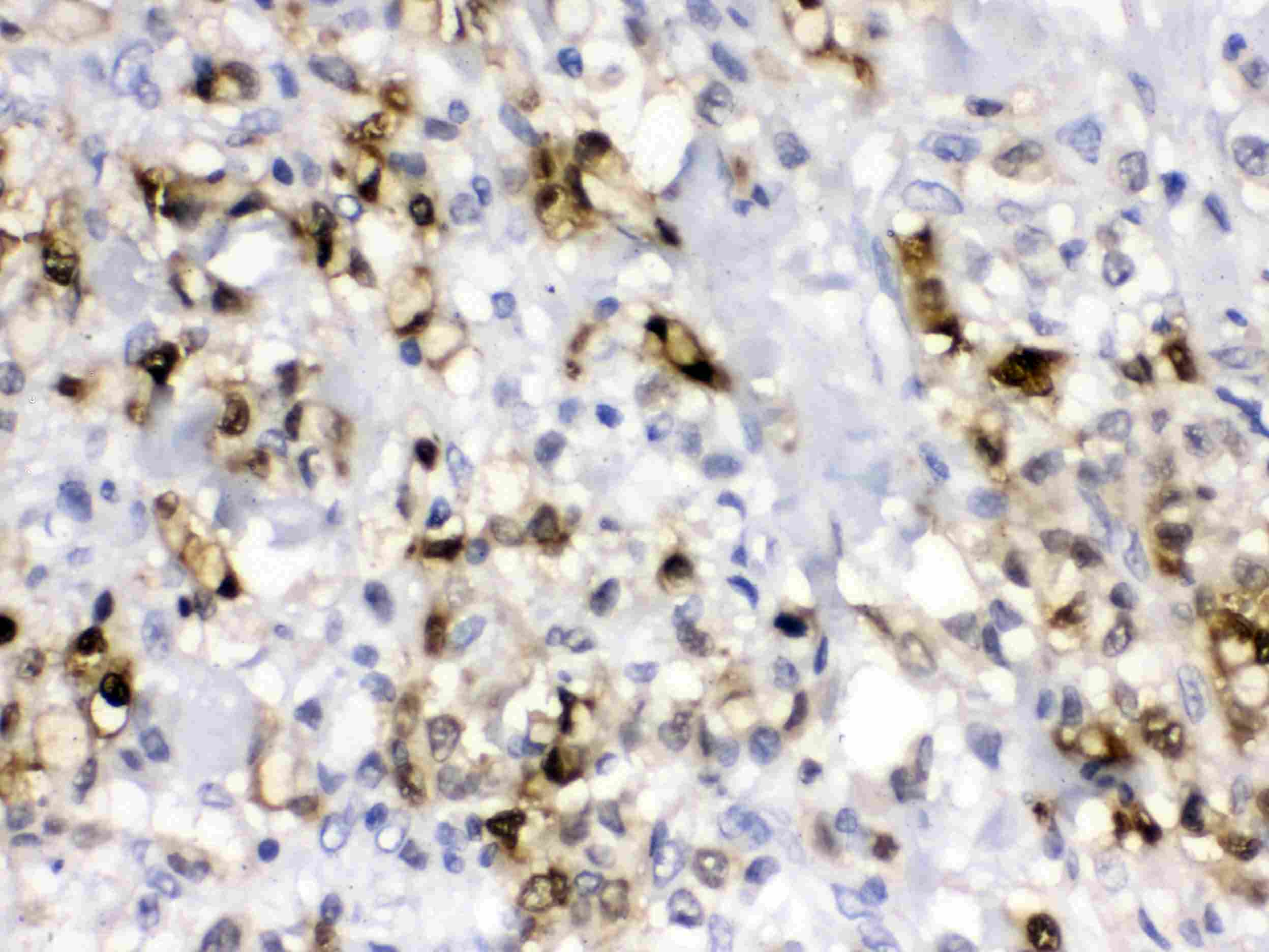 CA2 / Carbonic Anhydrase II Antibody