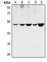 CYP11B1+2 Antibody