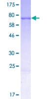 Human KRT28 / Keratin 28 Protein (Recombinant GST)