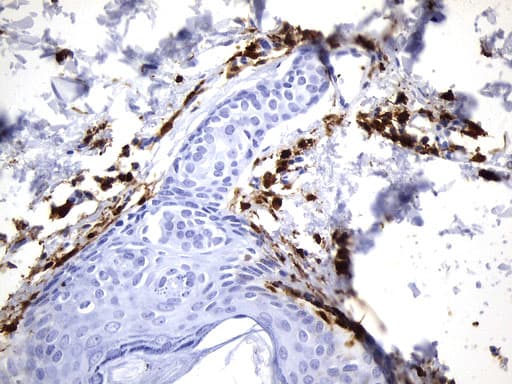 F13A1 / Factor XIIIa Antibody (clone UMAB243)