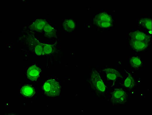 Polyclonal Rabbit anti-Human GNAQ Antibody (IHC, IF)