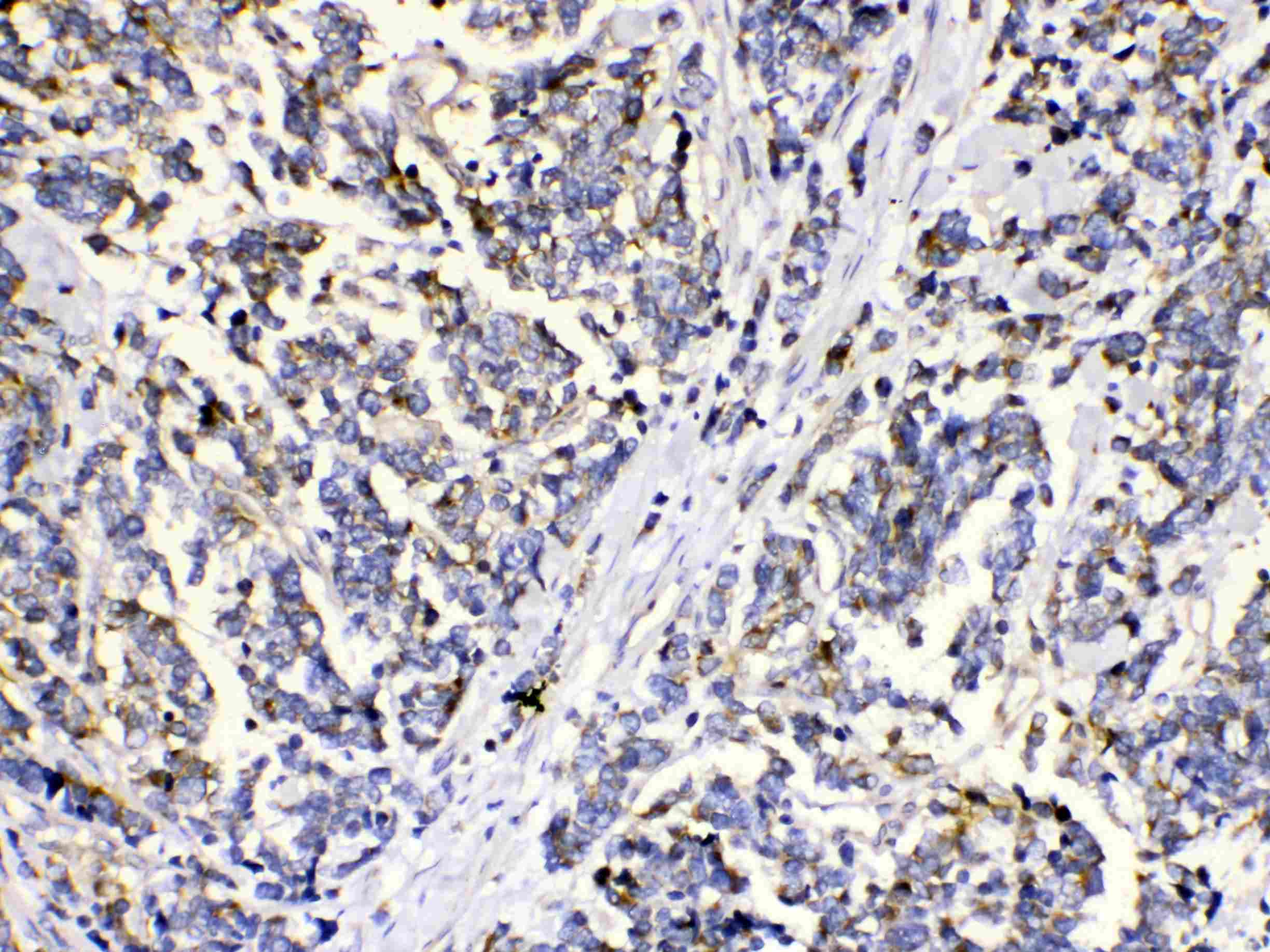 MUT / MCM Antibody