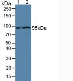 FBLN1 / Fibulin 1 Antibody (aa399-578)