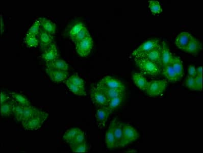 Polyclonal Rabbit anti-Human PRUNE Antibody (IHC)