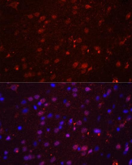 GRIN2B / NMDAR2B / NR2B Antibody