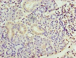 Polyclonal Rabbit anti-Human SMYD4 Antibody (aa1-260, IHC, WB)
