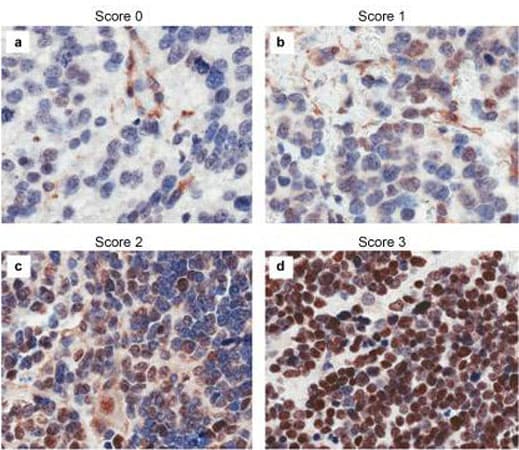 CASZ1 Antibody
