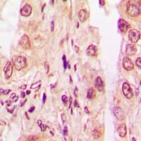 EIF5 Antibody
