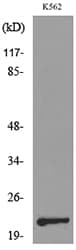 IL6 / Interleukin 6 Antibody
