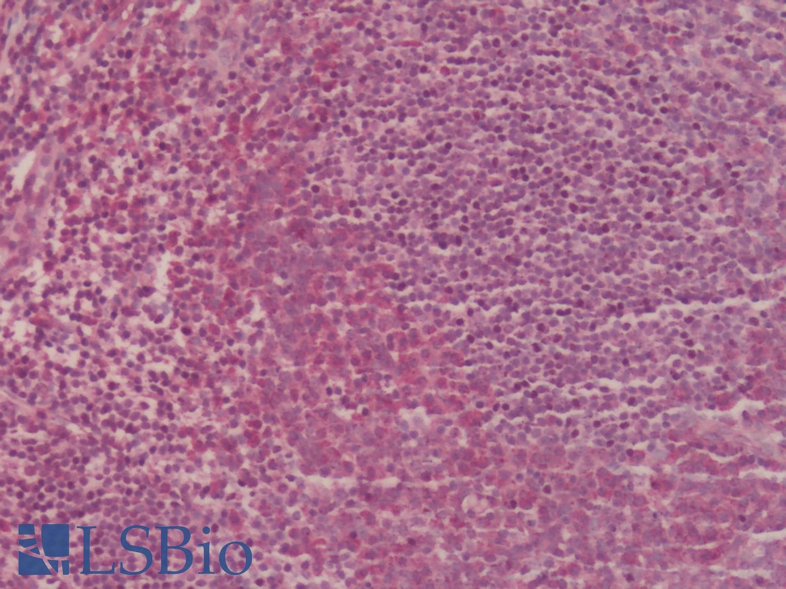 IHC-plus™ Polyclonal Rabbit anti-Human CCR2 Antibody (Extracellular Domain, IHC)