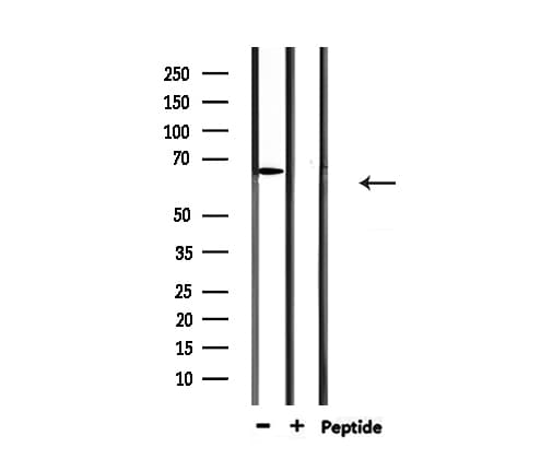 PIAS2 / PIASX Antibody