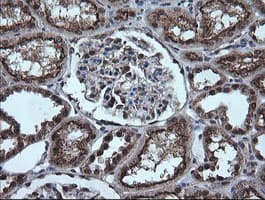 ESRRG / ERR Gamma Antibody (clone OTI6G1)
