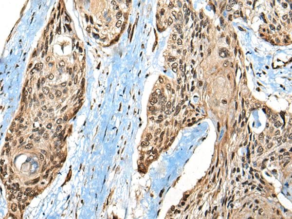 CASK Antibody