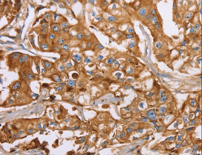 Polyclonal Rabbit anti-Human LF / LTF / Lactoferrin Antibody (IHC, WB)