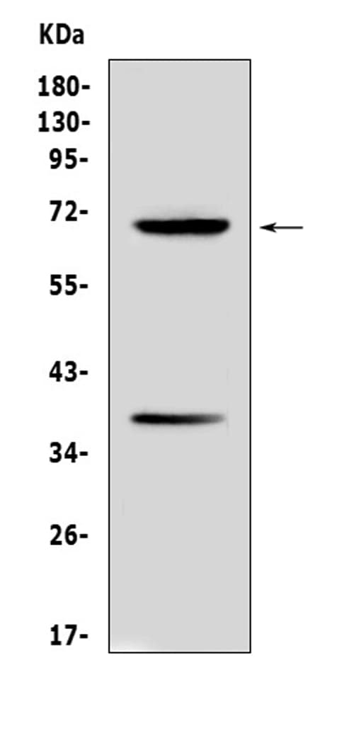 Polyclonal Rabbit anti-Mouse Alpha-Fetoprotein Antibody (WB)
