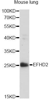 Polyclonal Rabbit anti-Human EFHD2 Antibody (WB)