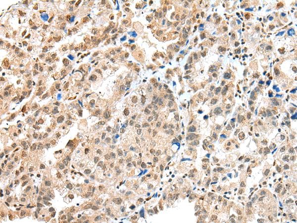 Polyclonal Rabbit anti-Human S100A16 Antibody (IHC, WB)