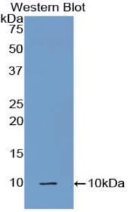 Complement C5a Antibody (aa679-755)