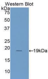 IL1RN Antibody (aa26-177)