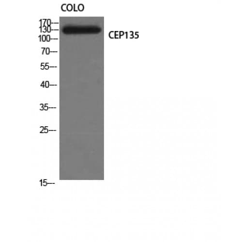 CEP135 Antibody (1050-1130 aa, C-terminal)