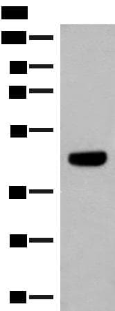 Polyclonal Rabbit anti-Human GNAT1 Antibody (IHC, WB)