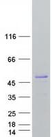 Human ARFGAP1 Protein (Recombinant Myc-DDK (Flag))