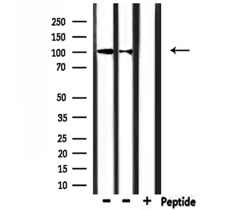 Polyclonal Rabbit anti-Human CHSY3 / CSS3 Antibody (WB)