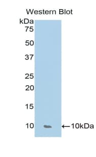 CCL17 / TARC Antibody (aa27-93)
