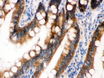 Polyclonal Rabbit anti-Human RENT1 / UPF1 Antibody (IHC, WB)