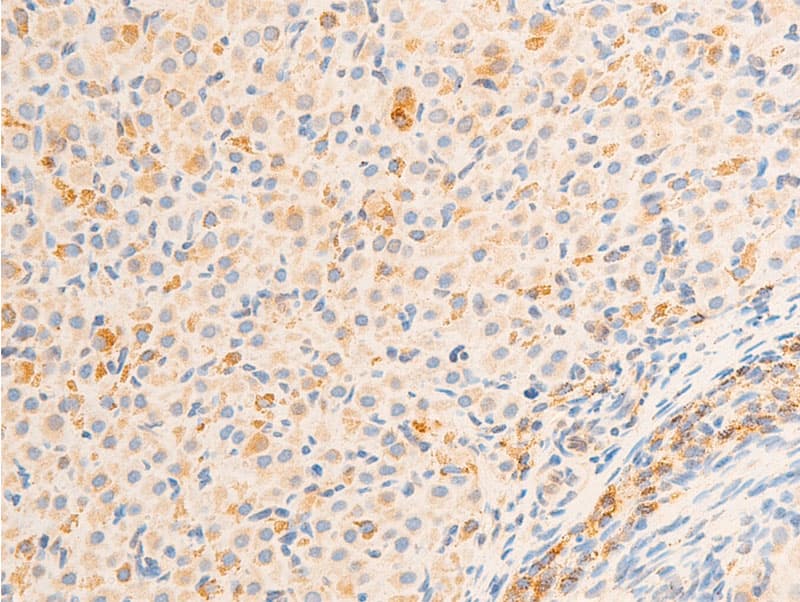 RELA / NFKB p65 Antibody (phospho-Ser536)