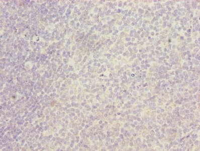 ITGAL / CD11a Antibody