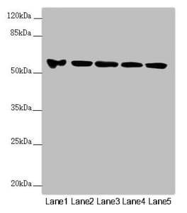 FOXRED1 Antibody