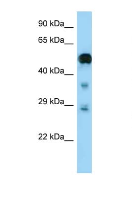 NF2 / Merlin Antibody (aa357-406)