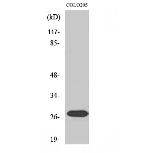 NRIP3 Antibody (170-250 aa, C-terminal)