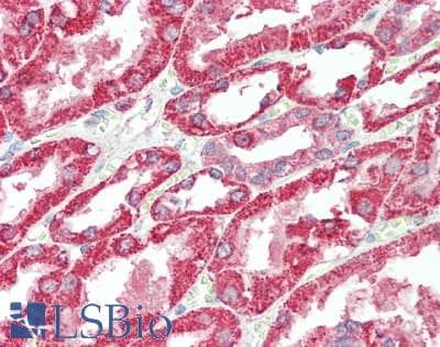 IHC-plus™ ITPR3 Antibody (aa625-675)