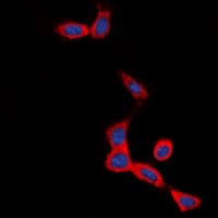 SCTR / SR / Secretin Receptor Antibody (Internal)