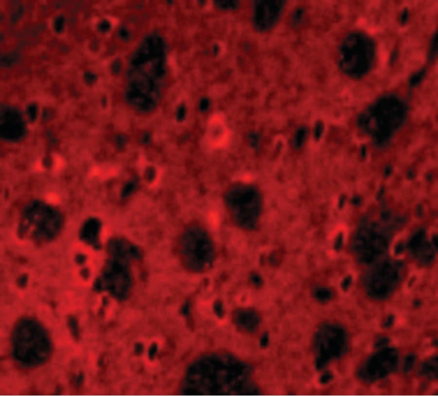 Polyclonal Rabbit anti-Human APP / Beta Amyloid Precursor Antibody (IHC, IF, WB)