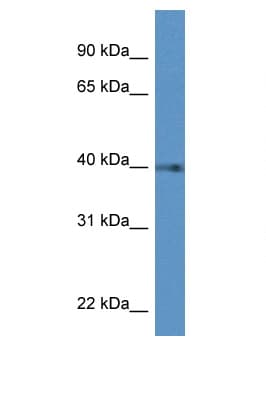 Prostaglandin D2 Receptor Antibody (aa290-339)