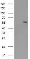 PPARA / PPAR Alpha Antibody (aa145-420, clone OTI2G6)