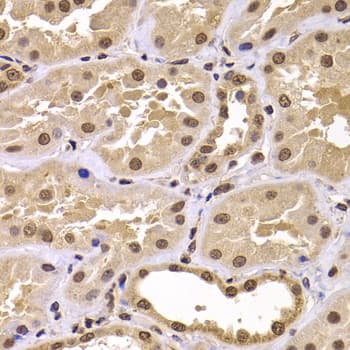 IHC-plus™ CSRP2BP Antibody