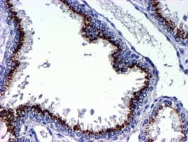 GOLM1 / GP73 / GOLPH2 Antibody (clone OTI2F3)