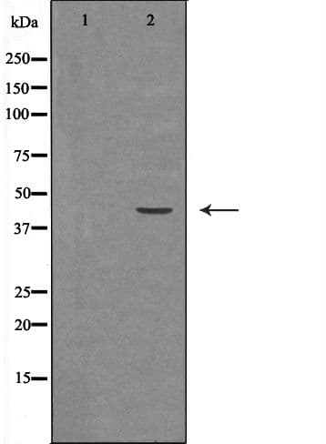 HSD3B2 Antibody