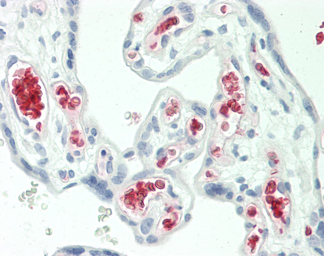 HBG2 / Hemoglobin Gamma 2 Antibody (aa56-105)