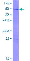 Human SS18 Protein (Recombinant GST)