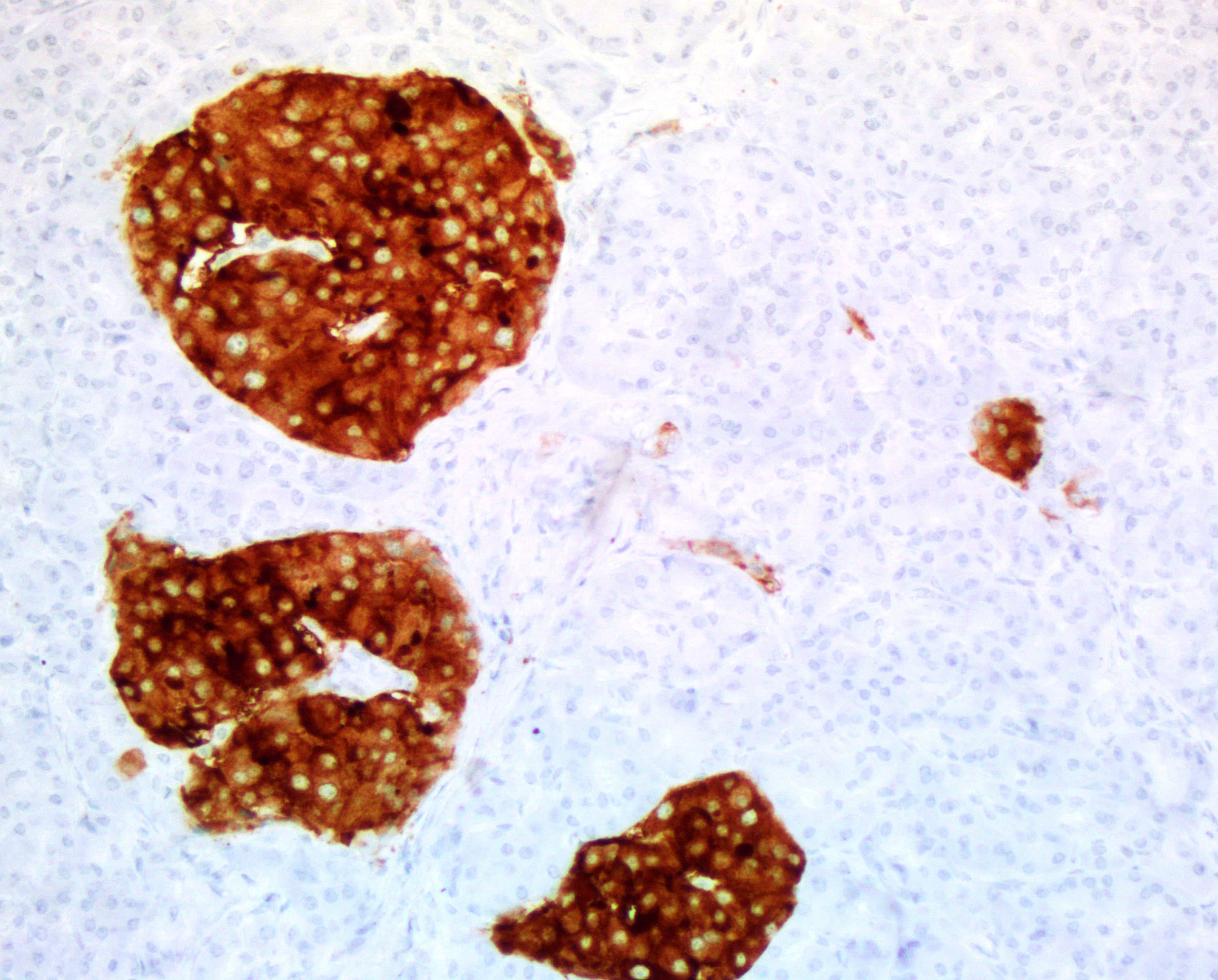 Monoclonal Mouse anti-Human SYP / Synaptophysin Antibody (clone UMAB112, Carrier-free, IHC, IF, WB)