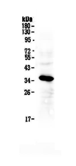 IGFBP2 / IGF-BP53 Antibody